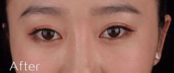 点击看大图 -SKINIST丽铂医疗美容