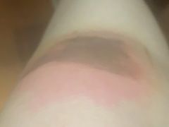 -深圳市第二人民医院中西医结合分院门诊楼