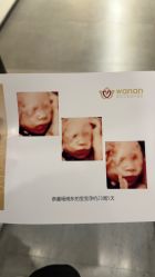 -郑州万安妇产医院