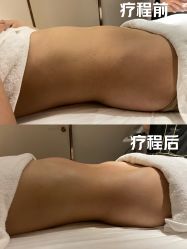 -Fundi张玉珊修身堂·indiba·BTL科技瘦身