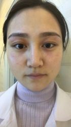 体验后-西美医疗美容门诊部