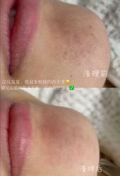 点击看大图 -春田皮肤管理中心品牌旗舰店