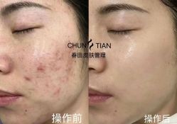 -春田皮肤管理中心品牌旗舰店