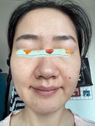 体验后-重庆军科整形美容医院