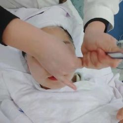 -蕾特恩专业祛痘