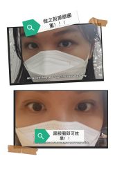 体验前-深圳春天阳光医院·轮廓抗衰中心