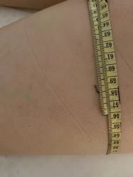 -肥三针腧穴瘦身馆