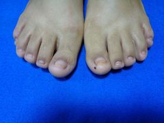 -世龙世家甲沟炎·灰指甲·嵌甲矫正·修脚(武侯区双楠店)