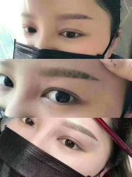 -MLP美丽派·问题肌疗愈中心