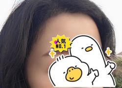 -大麦微针植发全国连锁