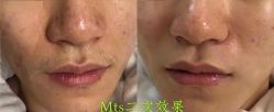 -康美贞·痘肌养护管理中心