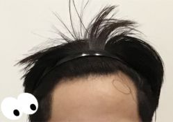 -大麦微针植发全国连锁