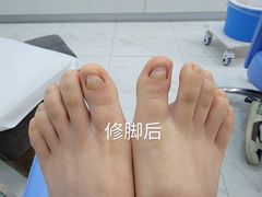 -Andrew指甲专科灰指甲·甲沟炎矫正·3D步态矫形鞋垫定制(浦三路店)