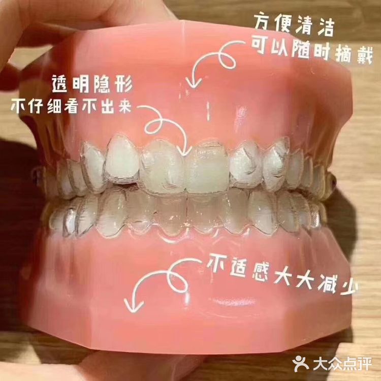 隐形牙套、钢托槽、陶瓷托槽的区别  