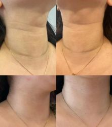 -郡艺医疗美容·微整·眼鼻吸脂