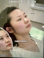 -Yestar艺星医疗美容医院