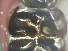 -精德口腔·种植修复·儿牙中心(财富中心店)