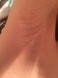 -成都苗方清颜专业祛痘