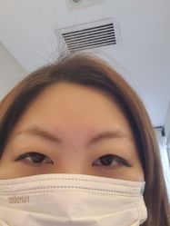 体验后-北京楚诺医疗美容