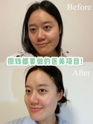 点击看大图 -Yestar艺星医疗美容医院