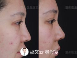 -北京米扬丽格医疗美容·联合丽格鼻整形中心