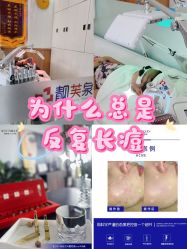 -靓芙泉专研痘痘肌