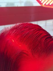 -碧莲盛·不剃发植发