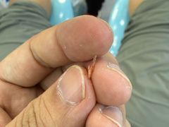 -世龙世家甲沟炎·灰指甲·嵌甲矫正·修脚(武侯区双楠店)