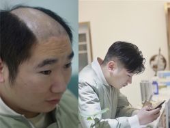 -发饰美男士增发补发假发定制店