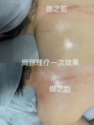 -Lily纤美·科技减脂中心