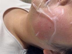 -长沙雅美医疗美容医院