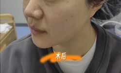-长沙雅美医疗美容医院