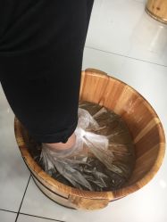 -派恩宜灰指甲·甲沟炎·鸡眼康护