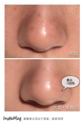 脸部抗衰-光SPA科技美肤