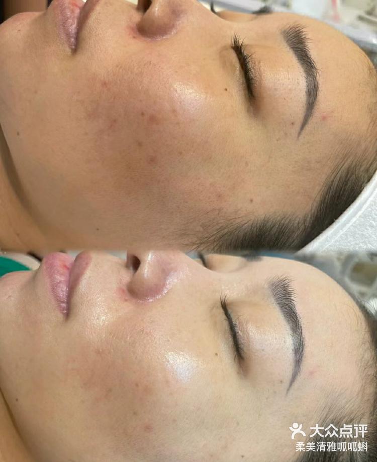 女人皮肤暗黄是气血不足吗百科在线