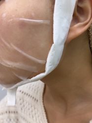 -宁波美莱整形美容