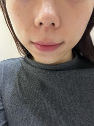 -HEYAN荷妍专业脱毛连锁机构