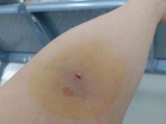 -成都市第一人民医院(南区)