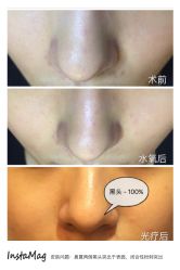 脸部抗衰-光SPA科技美肤