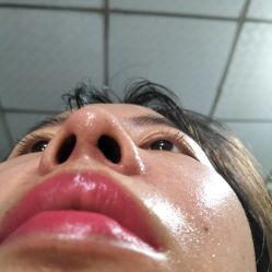 体验后-厦门美莱整形美容医院