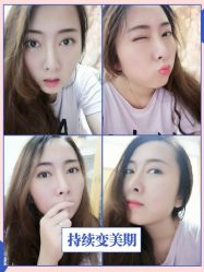 -广东韩妃整形外科医院