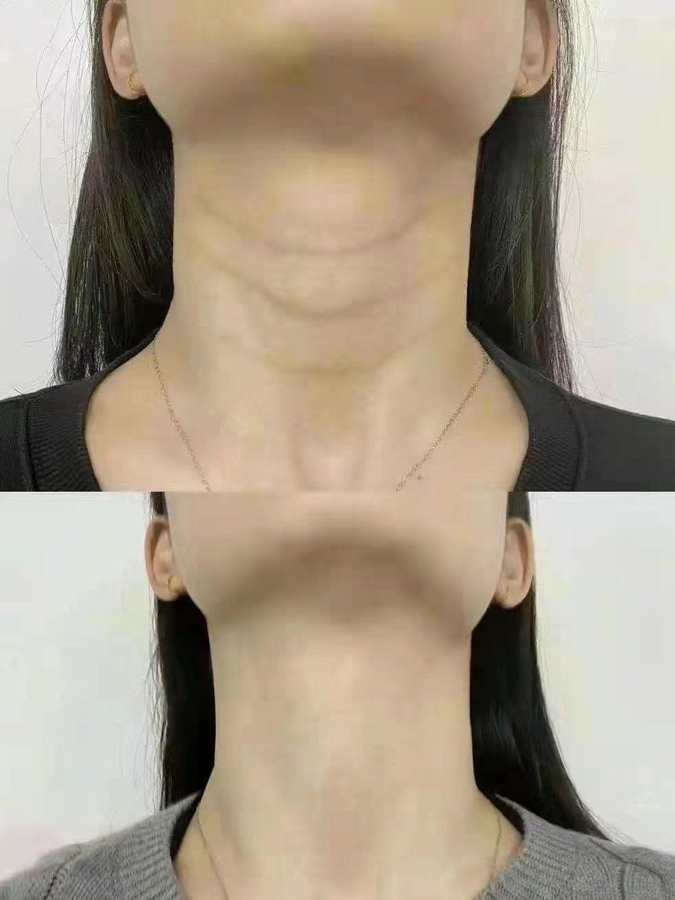 终于拥有梦寐以求的天鹅颈了!