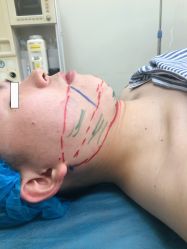 -洁铭新加坡医美