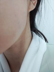 体验后-东剑医学美容·注射美学中心