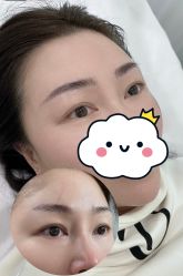 -张小野·专业半永久纹眉