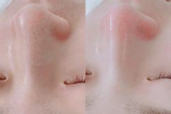 点击看大图 -玫莉蔻皮肤管理中心