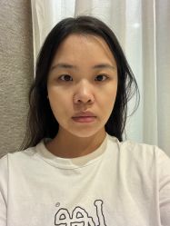 -深圳鹏爱秀琪医疗美容医院