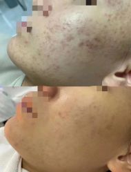 -康美贞·痘肌养护管理中心