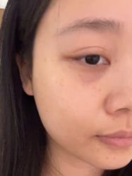 -广州美莱医疗美容医院