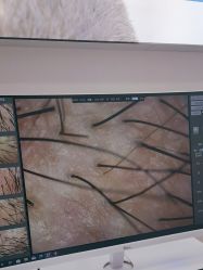 点击看大图 -大麦微针植发全国连锁